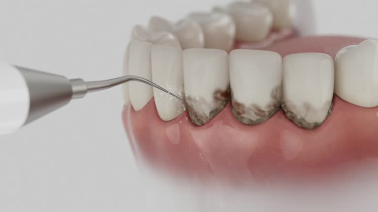 Reliable Dental contractor in Valley City, ND by Dentist Open Now